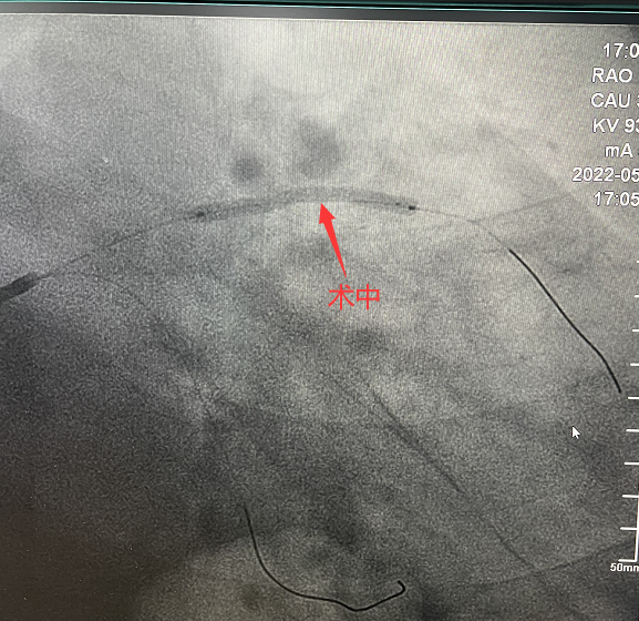 1652929554936360.png 1652929554936360.png