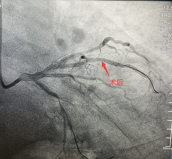 1652929592556555.png 1652929592556555.png