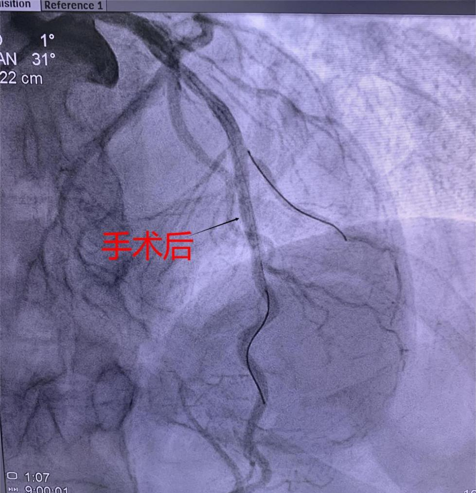 1663295842573407.png 3.png